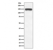 Western blot testing of human brain lysate with Collagen VI antibody. Predicted molecular weight ~109 kDa, routinely observed at 140-150 kDa.