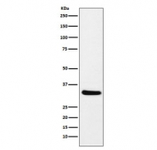 Western blot testing of mouse eyeball lysate with CRALBP antibody. Predicted molecular weight ~36 kDa.