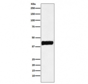 Western blot testing of human SH-SY5Y cell lysate with CKB antibody. Predicted molecular weight ~43 kDa.