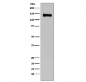 Western blot testing of rat C6 cell lysate with E-Cadherin antibody. Expected molecular weight: 135 kDa (precursor), 80-120 kDa (mature, depending on gylcosylation level).