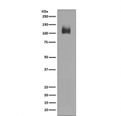Western blot testing of human JAR cell lysate with LAMP-2A antibody. This protein can be extensively glycosylated and has a visualized molecular weight from 45~110 kDa.