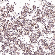 IHC staining of FFPE human pituitary tumor tissue with LAMP-2A antibody. HIER: boil tissue sections in pH6, 10mM citrate buffer, for 10-20 min and allow to cool before testing.