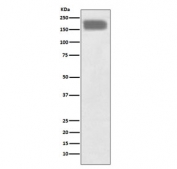 Western blot testing of human SH-SY5Y cell lysate with NCAM1 antibody. Predicted molecular weight: ~110 kDa (soluble fragment), ~120/125 kDa (GPI-anchored), 140/180 kDa (transmembrane isoforms).