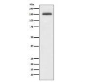 Western blot testing of human Jurkat cell lysate with ITGA4 antibody. Predicted molecular weight ~115 kDa, routinely observed at ~150 kDa.