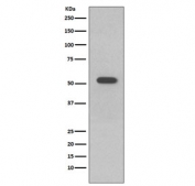 Western blot testing of human A431 cell lysate with Keratin 10 antibody. Predicted molecular weight ~59 kDa.