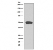 Western blot testing of human A431 cell lysate with KRT13 antibody. Predicted molecular weight ~50 kDa.