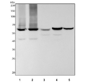 Western blot testing of 1) human A431, 2) human HaCaT, 3) rat skin, 4) mouse skin and 5) mouse thymus tissue lysate with KRT5 antibody. Predicted molecular weight: 58-62 kDa.