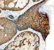 Immunohistochemical staining of FFPE human skin tissue with KRT5 antibody, HRP-secondary and DAB substrate. HIER: boil tissue sections in pH8 EDTA for 20 min and allow to cool before testing.