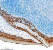 Immunohistochemical staining of FFPE human tonsil tissue with KRT5 antibody, HRP-secondary and DAB substrate. HIER: boil tissue sections in pH8 EDTA for 20 min and allow to cool before testing.
