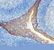 Immunohistochemical staining of FFPE human tonsil tissue with KRT5 antibody, HRP-secondary and DAB substrate. HIER: boil tissue sections in pH8 EDTA for 20 min and allow to cool before testing.