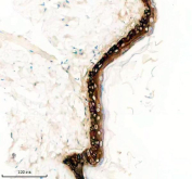 Immunohistochemical staining of FFPE rat skin tissue with KRT5 antibody, HRP-secondary and DAB substrate. HIER: boil tissue sections in pH8 EDTA for 20 min and allow to cool before testing.