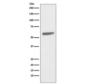 Western blot testing of human A431 cell lysate with Keratin 5 antibody. Predicted molecular weight: 58-62 kDa.