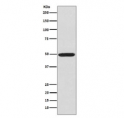 Western blot testing of human K562 cell lysate with phospho-PKA R2 antibody (pS99). Predicted molecular weight ~46 kDa.