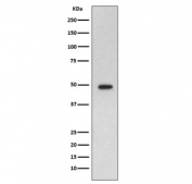 Western blot testing of rat brain lysate with GFAP antibody. Predicted molecular weight ~50 kDa.