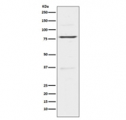Western blot testing of human HeLa cell lysatse with INSRR antibody. Expected molecular weight: ~80 kDa, 144 kDa.