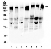 Western blot testing of human 1) U-87 MG, 2) HEK293, 3) T-47D, 4) HepG2, 5) A549, 6) PC-3 and 7) HeLa lysate with ROBO1 antibody. Expected molecular weight: 181-250 kDa depending on level of glycosylation.
