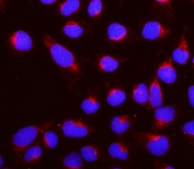 Immunofluorescent staining of FFPE human U-2 OS cells with ROBO1 antibody (red) at 2ug/ml and DAPI nuclear stain (blue). HIER: steam section in pH6 citrate buffer for 20 min.