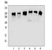 Western blot testing of human 1) U-87 MG, 2) HEK293, 3) HepG2, 4) A549, 5) PC-3 and 6) HeLa lysate with ROBO1 antibody. Expected molecular weight: 181-250 kDa depending on level of glycosylation.