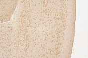 IHC staining of FFPE mouse brain with Semaphorin 3B antibody. HIER: boil tissue sections in pH8 EDTA for 20 min and allow to cool before testing.