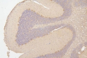 IHC staining of FFPE rat brain with Semaphorin 3B antibody. HIER: boil tissue sections in pH8 EDTA for 20 min and allow to cool before testing.
