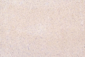 IHC staining of FFPE rat brain with Semaphorin 3B antibody. HIER: boil tissue sections in pH8 EDTA for 20 min and allow to cool before testing.