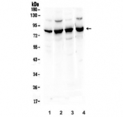 Western blot testing of human 1) placenta, 2) U-2 OS, 3) A549 and 4) U-87 MG lysate with Semaphorin 3B antibody. Predicted molecular weight ~83 kDa.