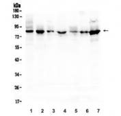 Western blot testing of 1) rat thymus, 2) rat kidney and mouse 3) thymus, 4) lung, 5) small intestine, 6) kidney and 7) HEPA1-6 lysate with Semaphorin 3B antibody. Predicted molecular weight ~83 kDa.