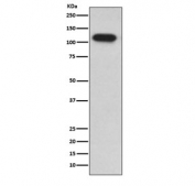 Western blot testing of human HepG2 cell lysate with IDE antibody. Predicted molecular weight ~118 kDa.