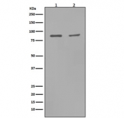 Western blot testing with MMP9 antibody. Expected molecular weight: ~92 kDa (precursor), 67-80 kDa (mature).