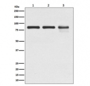Western blot testing of 1) human A431, 2) mouse NIH3T3 and 3) rat C6 cell lysate with Gamma Catenin antibody. Predicted molecular weight ~86 kDa.