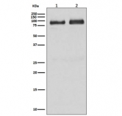 Western blot testing of human 1) brain and 2) HepG2 lysate with BRAF antibody. Predicted molecular weight: 85-95 kDa.