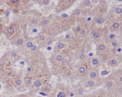 IHC staining of FFPE human liver with Glutamine Synthetase antibody. HIER: boil tissue sections in pH6, 10mM citrate buffer, for 10-20 min and allow to cool before testing.