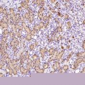 Immunohistochemistry of Glutamine Synthetase Antibody in rat kidney. Formalin-fixed, paraffin-embedded rat kidney tissue demonstrates cytoplasmic HRP-DAB brown staining in renal tubular epithelial cells, consistent with Glutamate-ammonia ligase (GLUL) expression in metabolically active nephron segments. Glomerular structures show comparatively lower staining intensity. The antibody was applied at a 1:400 dilution for paraffin-embedded tissue analysis.