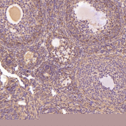 Immunohistochemistry of Glutamine Synthetase Antibody in mouse ovary. Formalin-fixed, paraffin-embedded mouse ovarian tissue demonstrates cytoplasmic HRP-DAB brown staining in granulosa cells and stromal cell populations, consistent with Glutamate-ammonia ligase (GLUL) localization in metabolically active ovarian compartments. Oocyte nuclei remain unstained, while surrounding follicular cells show diffuse cytoplasmic signal. The antibody was applied at a 1:400 dilution for paraffin-embedded tissue analysis.