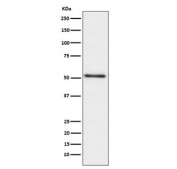 Western blot testing of human prostate cancer lysate with ACPP antibody. Expected molecular weight: 45-50 kDa.