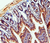 IHC staining of FFPE mouse small intestine with TDRD3 antibody at 1ug/ml. HIER: boil tissue sections in pH6, 10mM citrate buffer, for 10-20 min and allow to cool before testing.