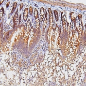 IHC staining of FFPE rat small intestine with TDRD3 antibody at 1ug/ml. HIER: boil tissue sections in pH6, 10mM citrate buffer, for 10-20 min and allow to cool before testing.