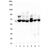 Western blot testing of human 1) placenta, 2) HL-60, 3) HeLa, 4) PC-3, 5) HEK293, 6) A549 and 7) A431 lysate with TDRD3 antibody at 0.5ug/ml. Expected molecular weight: 73-83 kDa.