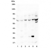 Western blot testing of 1) rat brain, 2) rat liver and mouse 3) brain, 4) lung, 5) liver and 6) NIH3T3 lysate with TDRD3 antibody at 0.5ug/ml. Expected molecular weight: 73-83 kDa.
