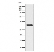 Western blot testing of lysate from human HeLa cells treated with Calyculin A, with phospho-RPA32 antibody (pT21). Predicted molecular weight ~32 kDa.