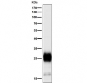 Western blot testing of human MCF7 cell lysate with Mucin-1 antibody at 1:3000 dilution. Expected molecular weight: 17-25 kDa depending on glycosylation level.