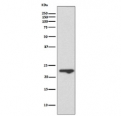 Western blot testing of human T-47D cell lysate with Mucin-1 antibody. Expected molecular weight: 17-25 kDa depending on glycosylation level.