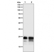 Western blot testing of mouse 1) stomach and 2) pancreas tissue lysate with Mucin-1 antibody at 1:5000 dilution. Expected molecular weight: 17-25 kDa depending on glycosylation level.