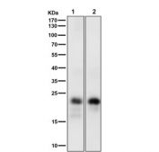 Western blot testing of 1) mouse lung and 2) rat lung tissue lysate with Mucin-1 antibody at 1:5000 dilution. Expected molecular weight: 17-25 kDa depending on glycosylation level.