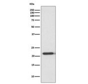 Western blot testing of human HeLa cell lysate with TIMP2 antibody. Predicted molecular weight ~24 kDa.