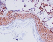 IHC staining of FFPE human skin with CD44 antibody. HIER: boil tissue sections in pH6, 10mM citrate buffer, for 10-20 min and allow to cool before testing.