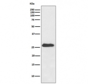 Western blot testing of mouse heart lysaste with NQO2 antibody. Predicted molecular weight ~26 kDa.