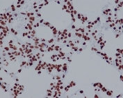 IHC staining of FFPE rat lung tissue with H2AFX antibody. HIER: boil tissue sections in pH6, 10mM citrate buffer, for 10-20 min and allow to cool before testing.