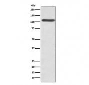 Western blot testing of HUVEC lysate with SELP antibody. Expected molecular weight: 86-140 kDa depending on glycosylation level.