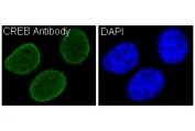 Immunofluorescent staining of FFPE human HeLa cells (green) and DAPI nuclear stain (blue). HIER: boil tissue sections in pH6, 10mM citrate buffer, for 10-20 min and allow to cool before testing.
